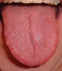 250px-Tongue.agr.jpg